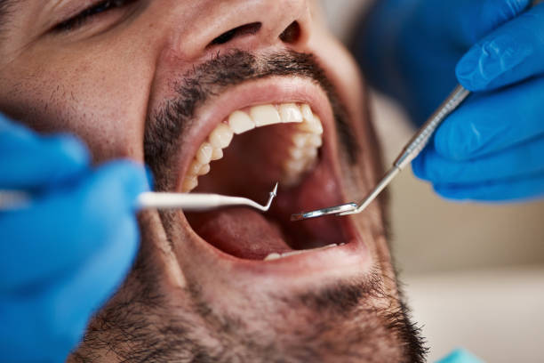 Best Emergency Tooth Extraction in Greenville, KY